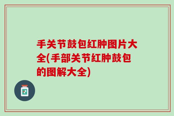 手关节鼓包红肿图片大全(手部关节红肿鼓包的图解大全)