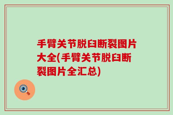 手臂关节脱臼断裂图片大全(手臂关节脱臼断裂图片全汇总)