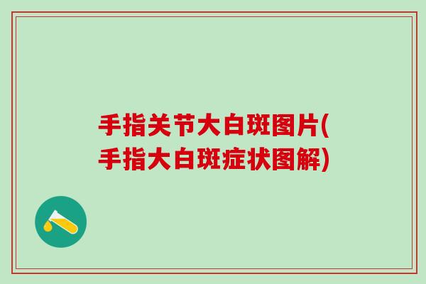 手指关节大白斑图片(手指大白斑症状图解)
