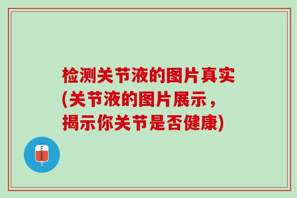 检测关节液的图片真实(关节液的图片展示，揭示你关节是否健康)