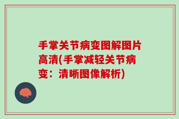 手掌关节病变图解图片高清(手掌减轻关节病变：清晰图像解析)