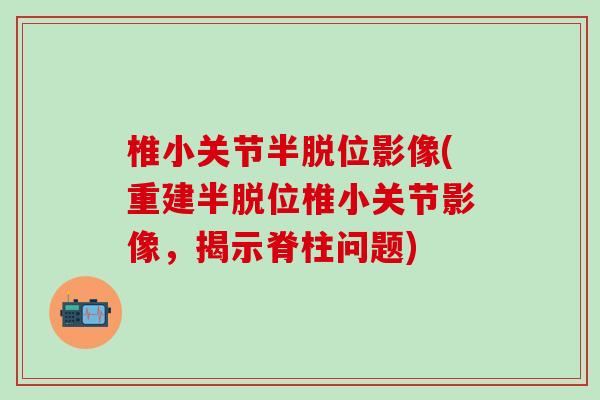 椎小关节半脱位影像(重建半脱位椎小关节影像，揭示脊柱问题)