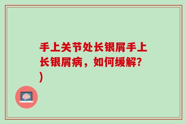 手上关节处长银屑手上长银屑病，如何缓解？)
