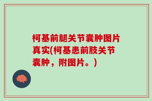 柯基前腿关节囊肿图片真实(柯基患前肢关节囊肿,附图片。) 柯基前腿关节囊肿图片真实(柯基患前肢关节囊肿,附图片。)