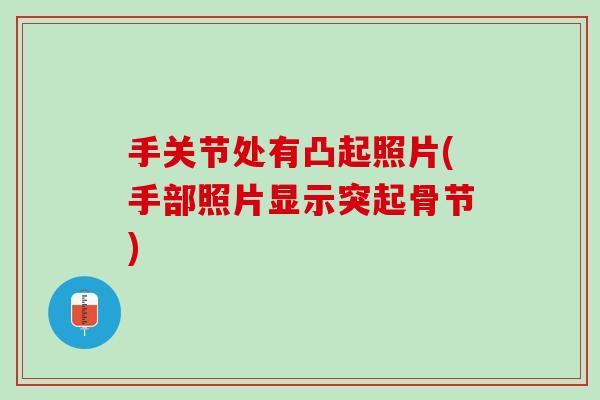 手关节处有凸起照片(手部照片显示突起骨节) 手关节处有凸起照片(手部照片显示突起骨节)