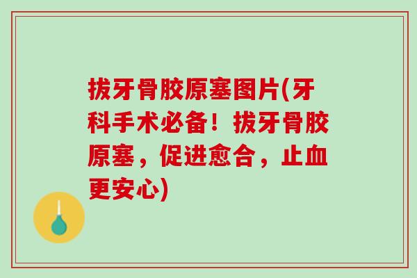 拔牙骨胶原塞图片(牙科手术必备！拔牙骨胶原塞，促进愈合，止血更安心)
