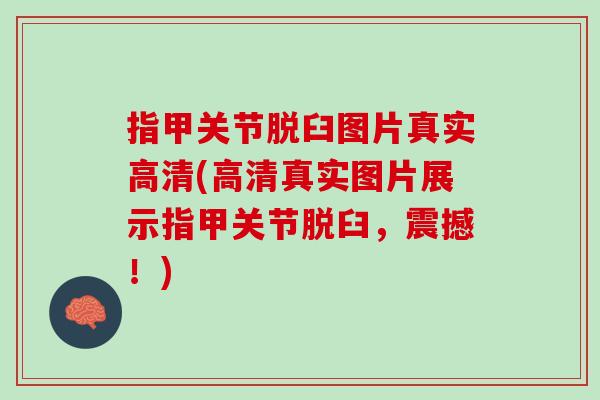 指甲关节脱臼图片真实高清(高清真实图片展示指甲关节脱臼，震撼！)