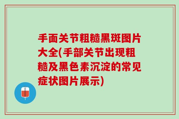 手面关节粗糙黑斑图片大全(手部关节出现粗糙及黑色素沉淀的常见症状图片展示)