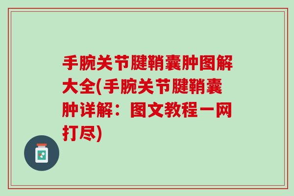 手腕关节腱鞘囊肿图解大全(手腕关节腱鞘囊肿详解：图文教程一网打尽)