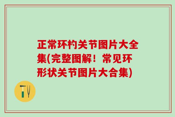 正常环杓关节图片大全集(完整图解！常见环形状关节图片大合集)
