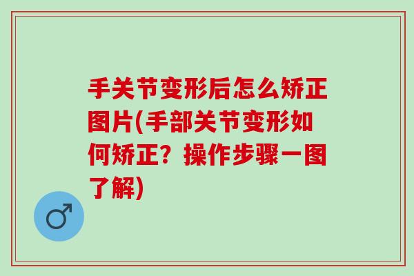 手关节变形后怎么矫正图片(手部关节变形如何矫正？操作步骤一图了解)