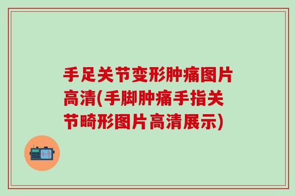 手足关节变形肿痛图片高清(手脚肿痛手指关节畸形图片高清展示)