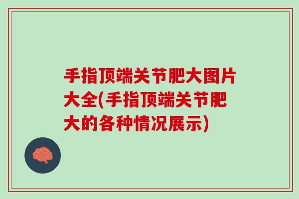 手指顶端关节肥大图片大全(手指顶端关节肥大的各种情况展示) 手指顶端关节肥大图片大全(手指顶端关节肥大的各种情况展示)