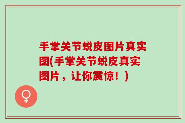 手掌关节蜕皮图片真实图(手掌关节蜕皮真实图片，让你震惊！)