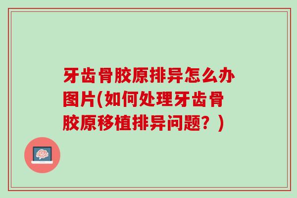 牙齿骨胶原排异怎么办图片(如何处理牙齿骨胶原移植排异问题？)