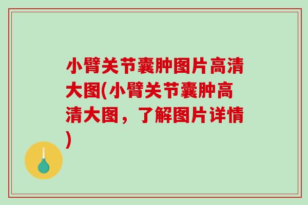小臂关节囊肿图片高清大图(小臂关节囊肿高清大图，了解图片详情)