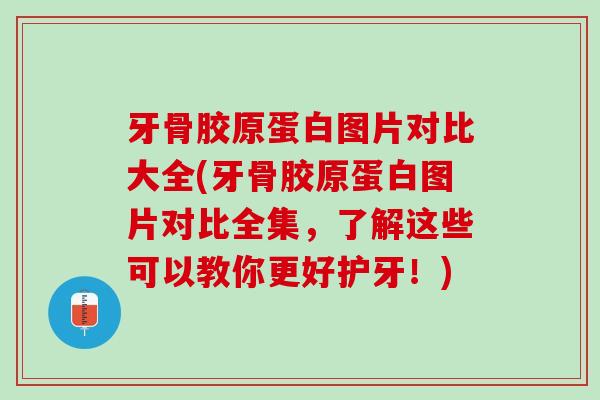 牙骨胶原蛋白图片对比大全(牙骨胶原蛋白图片对比全集，了解这些可以教你更好护牙！)