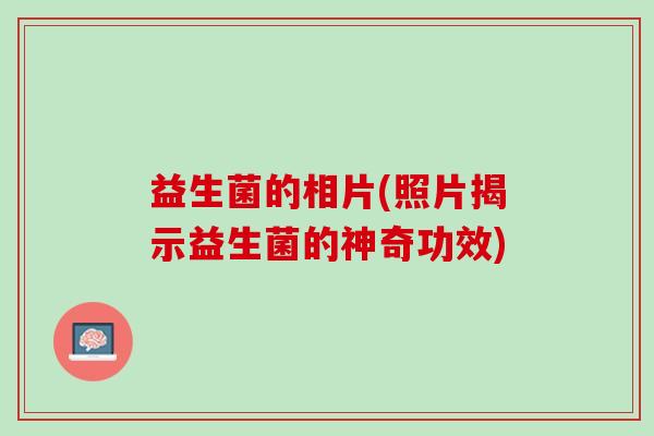 益生菌的相片(照片揭示益生菌的神奇功效)