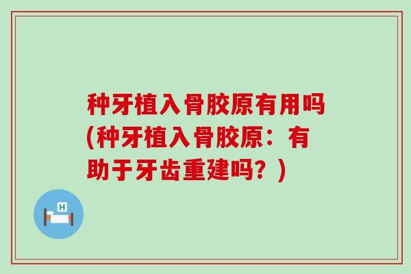 种牙植入骨胶原有用吗(种牙植入骨胶原：有助于牙齿重建吗？)