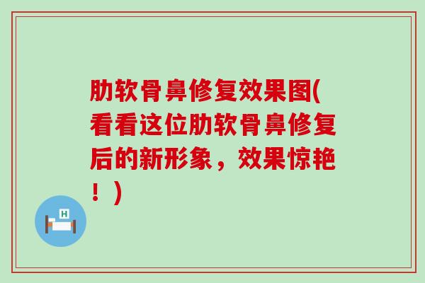 肋软骨鼻修复效果图(看看这位肋软骨鼻修复后的新形象，效果惊艳！)
