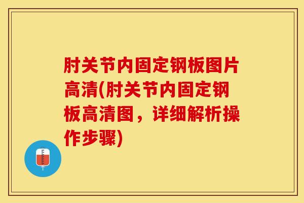 肘关节内固定钢板图片高清(肘关节内固定钢板高清图，详细解析操作步骤)