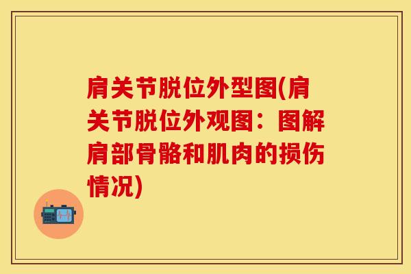 肩关节脱位外型图(肩关节脱位外观图：图解肩部骨骼和肌肉的损伤情况)