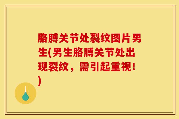 胳膊关节处裂纹图片男生(男生胳膊关节处出现裂纹，需引起重视！)