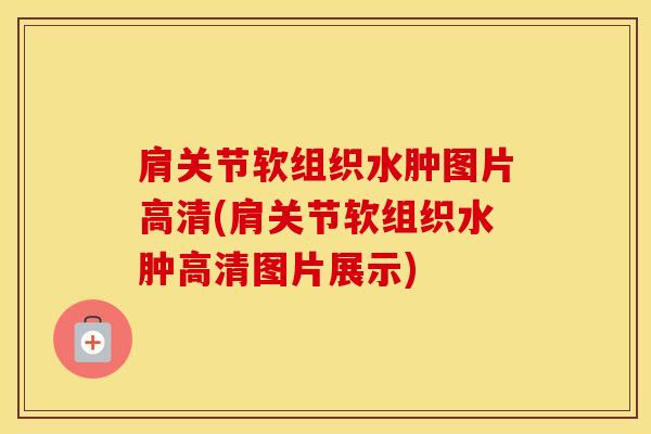 肩关节软组织水肿图片高清(肩关节软组织水肿高清图片展示)