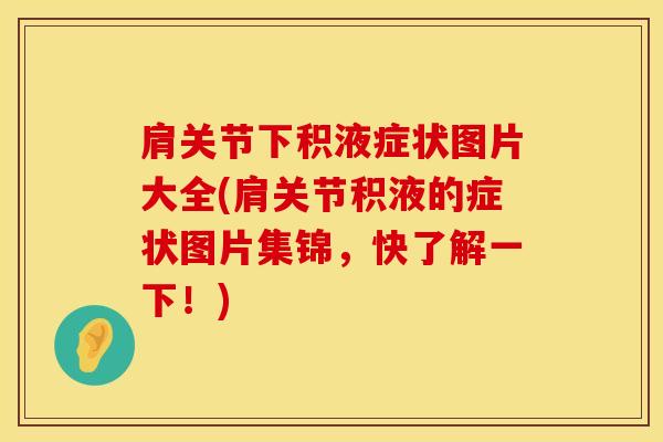 肩关节下积液症状图片大全(肩关节积液的症状图片集锦，快了解一下！)