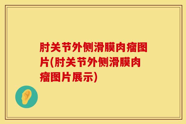 肘关节外侧滑膜肉瘤图片(肘关节外侧滑膜肉瘤图片展示)