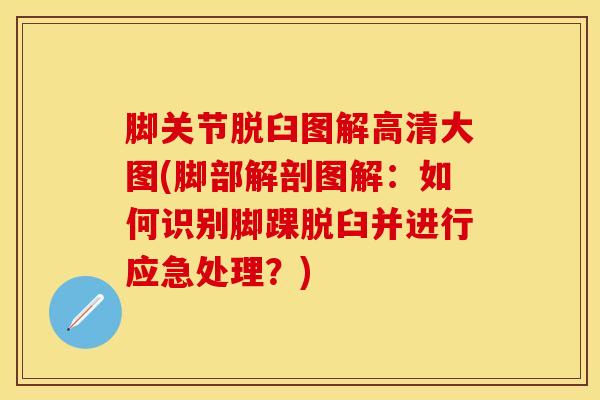 脚关节脱臼图解高清大图(脚部解剖图解：如何识别脚踝脱臼并进行应急处理？)