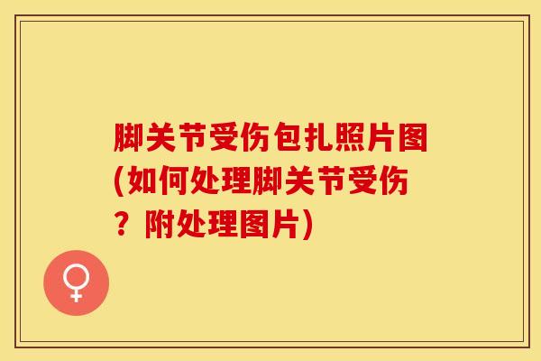 脚关节受伤包扎照片图(如何处理脚关节受伤？附处理图片)
