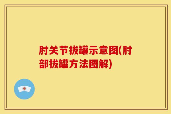 肘关节拔罐示意图(肘部拔罐方法图解)