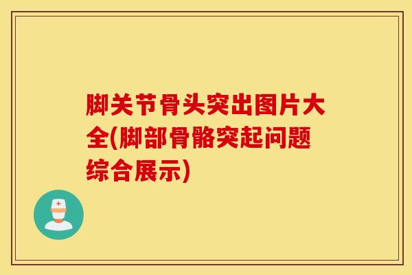 脚关节骨头突出图片大全(脚部骨骼突起问题综合展示)