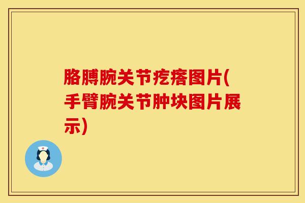 胳膊腕关节疙瘩图片(手臂腕关节肿块图片展示)
