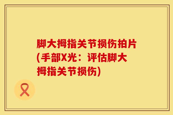 脚大拇指关节损伤拍片(手部X光：评估脚大拇指关节损伤)