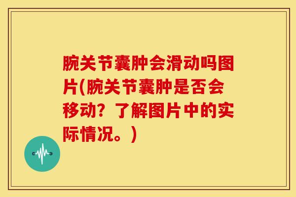 腕关节囊肿会滑动吗图片(腕关节囊肿是否会移动？了解图片中的实际情况。)