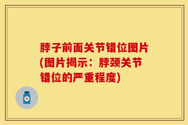 脖子前面关节错位图片(图片揭示：脖颈关节错位的严重程度)