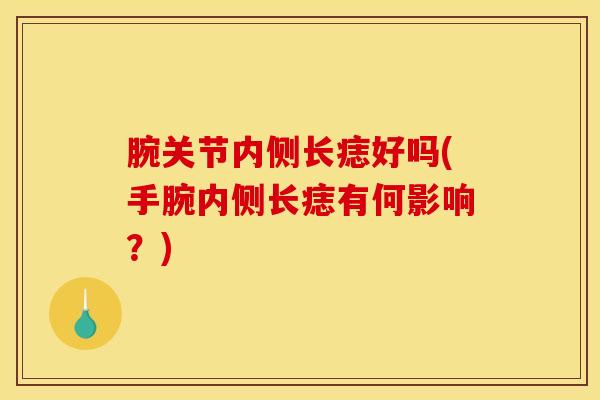 腕关节内侧长痣好吗(手腕内侧长痣有何影响？)
