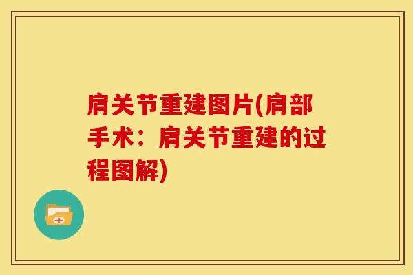 肩关节重建图片(肩部手术：肩关节重建的过程图解)