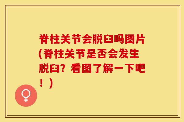 脊柱关节会脱臼吗图片(脊柱关节是否会发生脱臼？看图了解一下吧！)