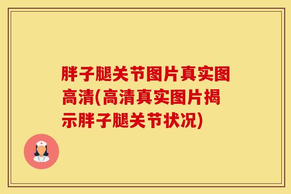 胖子腿关节图片真实图高清(高清真实图片揭示胖子腿关节状况)