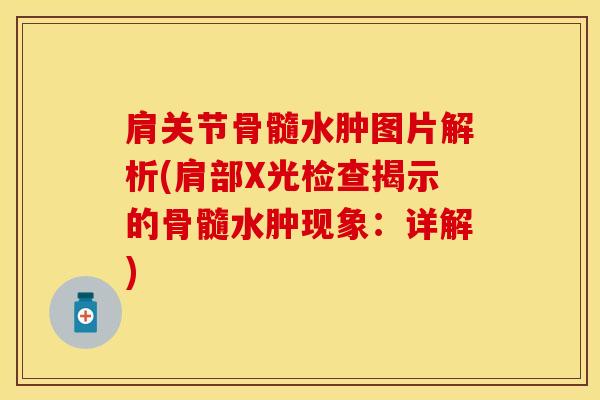 肩关节骨髓水肿图片解析(肩部X光检查揭示的骨髓水肿现象：详解)