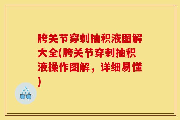 胯关节穿刺抽积液图解大全(胯关节穿刺抽积液操作图解，详细易懂)