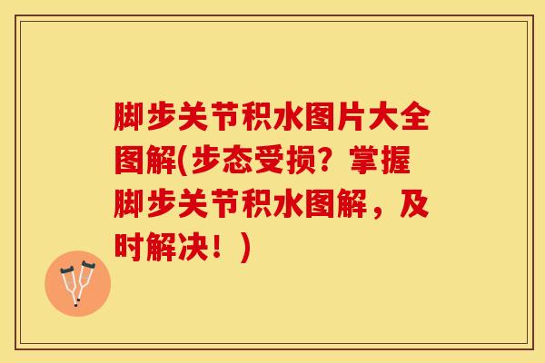 脚步关节积水图片大全图解(步态受损？掌握脚步关节积水图解，及时解决！)