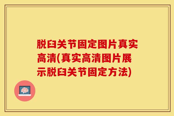 脱臼关节固定图片真实高清(真实高清图片展示脱臼关节固定方法)