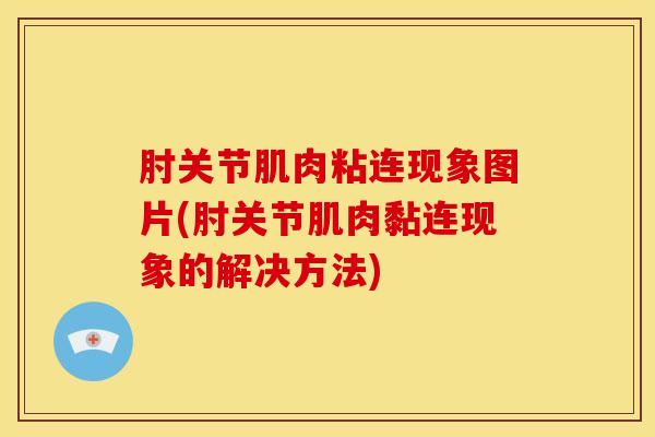 肘关节肌肉粘连现象图片(肘关节肌肉黏连现象的解决方法)
