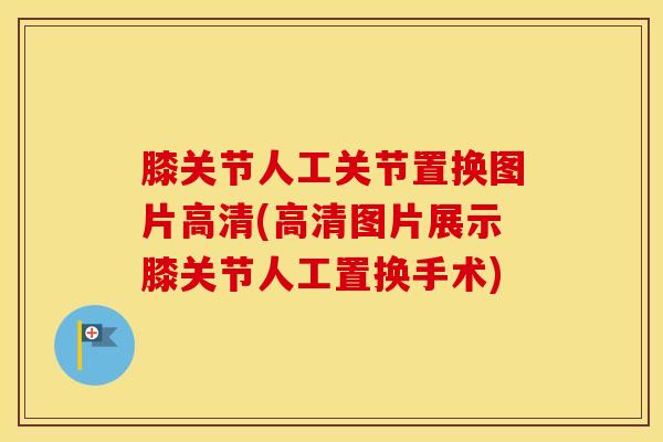 膝关节人工关节置换图片高清(高清图片展示膝关节人工置换手术)
