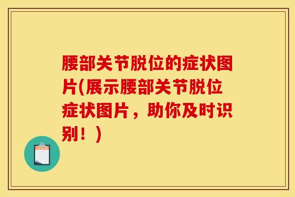 腰部关节脱位的症状图片(展示腰部关节脱位症状图片，助你及时识别！)