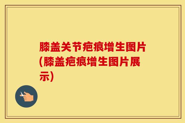 膝盖关节疤痕增生图片(膝盖疤痕增生图片展示)